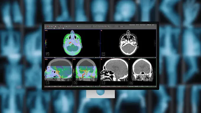 苹果 Studio Display XDR 医疗影像功能获 FDA 批准，本周开始推送