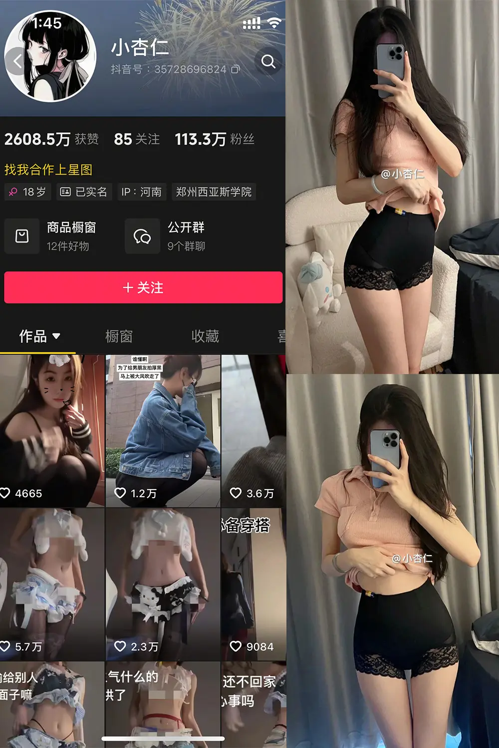 小杏仁微密圈