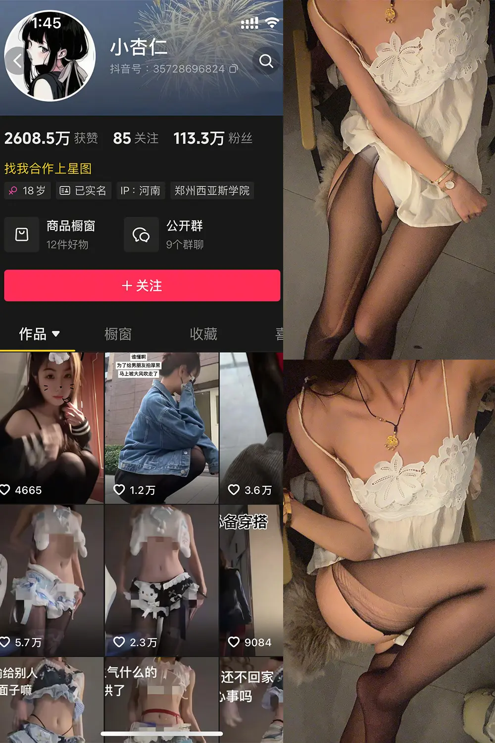 小杏仁微密圈