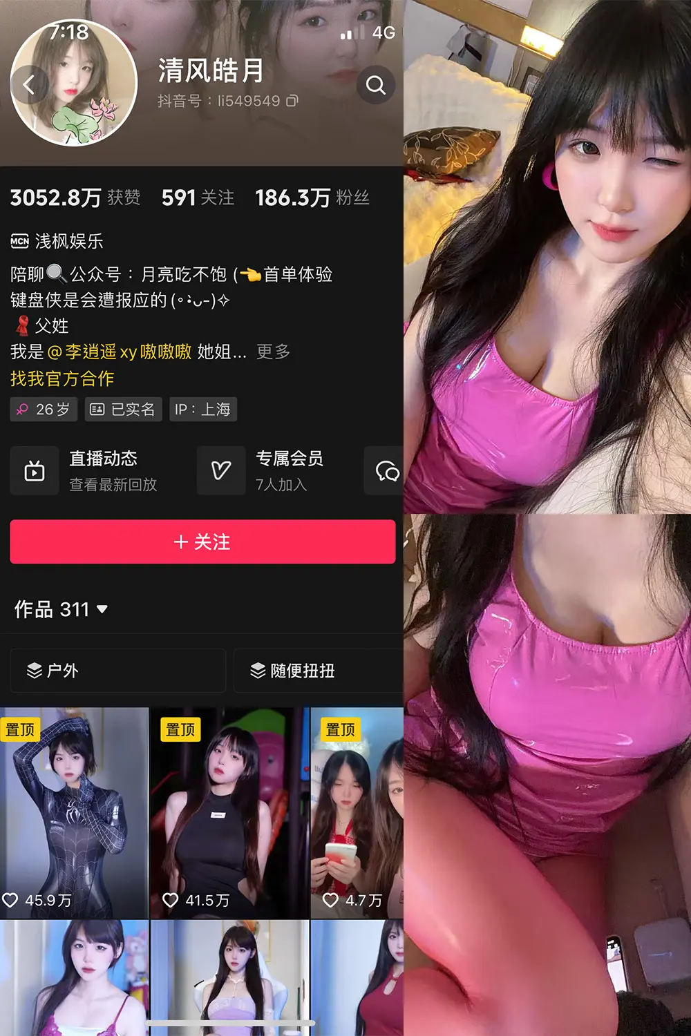 抖音 清风皓月 微密圈 | 觅圈 NO.003期 【18P6V】最新至：2025.5.25-佳人轩