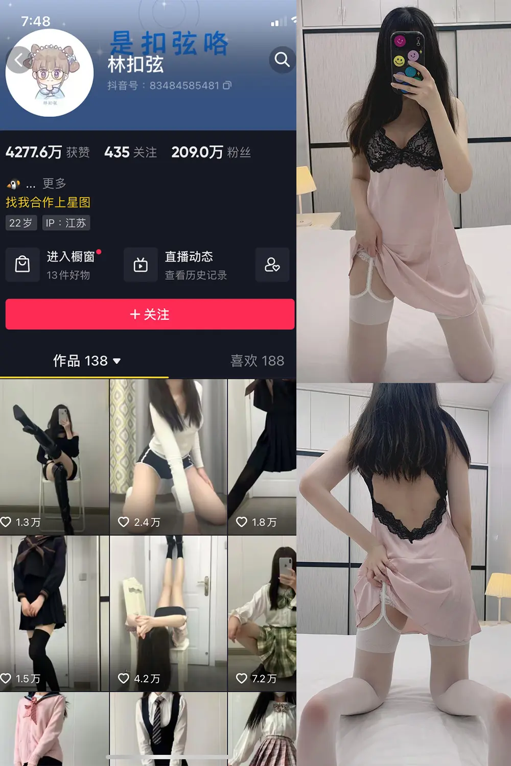 抖音 林扣弦 微密圈 NO.031期 【32P】-映美视界